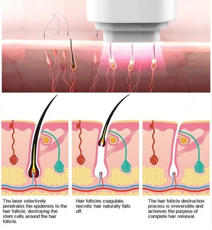Klinik Dr Bazilah Bangi : Hair Removal Laser Treatment