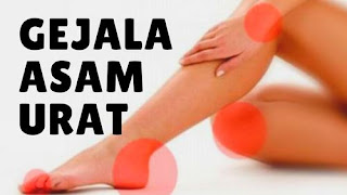 Asam Urat Tanaman Herbal, Obat Asam Urat Tradisional Daun Salam, Obat Alami Yang Bisa Menyembuhkan Penyakit Asam Urat, Obat Asam Urat Ramuan Sendiri, Ubat Asam Urat Herbal, Gejala Asam Urat Di Punggung, Obat Sakit Asam Urat Di Apotik, Cara Mengobati Asam Urat Yang Sudah Bengkak, Asam Urat Normal Setelah Makan, Obat Asam Urat Apa Sih, Asam Urat Bengkak Tangan, Penyebab Asam Urat Dan Pengobatannya, Asam Urat Harus Banyak Minum, Jus Alami Asam Urat, Cara Mengobati Penyakit Asam Urat Di Kaki, Standar Normal Kolesterol Asam Urat Gula Darah, Www.Obat Herbal Asam Urat Dan Kolesterol, Obat Alami Penurun Asam Urat, Asam Urat Pada Jari Kaki, Asam Urat Tanaman Herbal, Obat Asam Urat Dari Daun Sirsak, Makalah Asam Urat Dan Rematik, Buah Pantangan Asam Urat Dan Kolesterol, Cara Mudah Mengobati Sakit Asam Urat, Cara Mengobati Asam Urat Dengan Mengkudu, Obat Asam Urat Alami Yg Mujarab, Fungsi Obat Asam Urat, Sembuhkan Asam Urat Akut Dengan Pepaya, Obat Alami Penghilang Asam Urat, Obat Asam Urat Yang Bengkak  