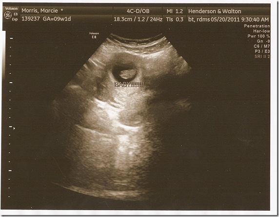 8 weeks 3 days2