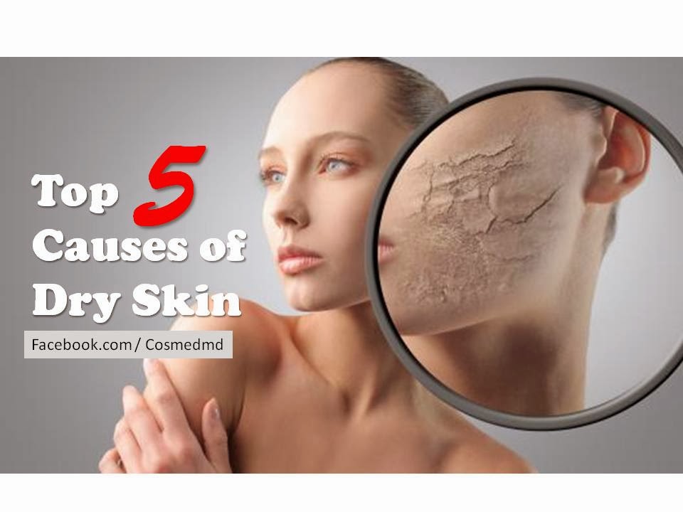 Top Five Causes Of Dry Skin