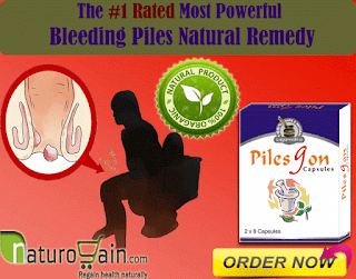 Bleeding Piles Natural Treatment