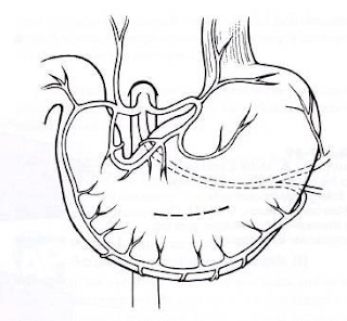 Teknik Operasi Gastrotomy & Rumenotomy pada Hewan (Bedah Digesti)