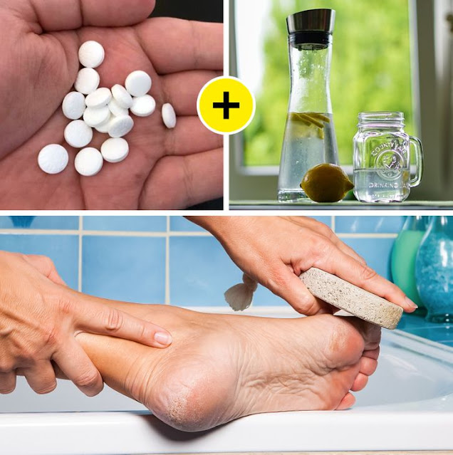 Une astuce simple pour soigner les callosités pieds avec aspirine