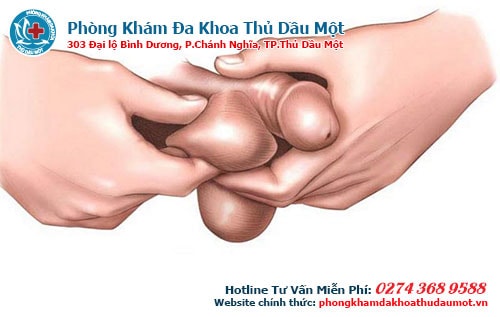 Địa chỉ gắn bi vào dương vật uy tín nhất Bình Dương