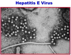 hepatitis e