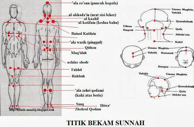 Bekam Mobile Pekan @ Bekam Cinta Sunnah: 2013