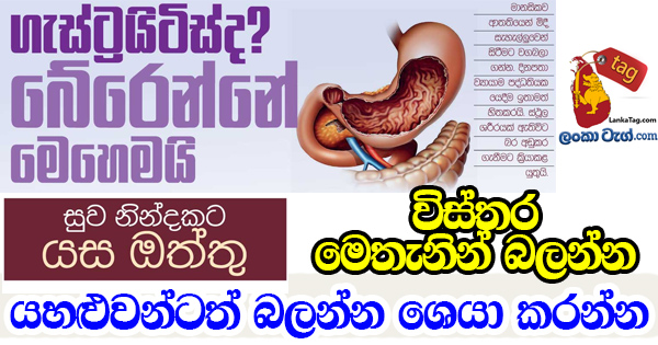 [Sinhala Article]-Gastritis