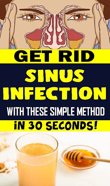 Get Rid Of Sinus Infection In 30 Seconds & This Simple Method & This Common Household Ingredient!!!