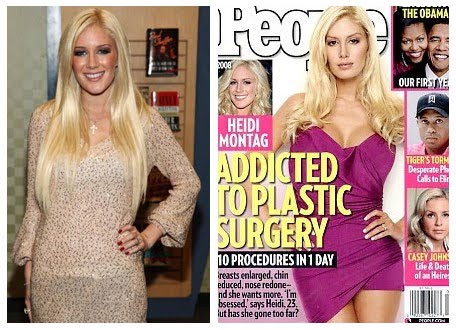 lady gaga before plastic surgery before after. heidi montag efore and after.