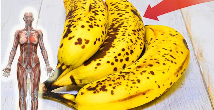 If You're A Banana Lover, Here Are 10 Awesome Benefits To Your Body