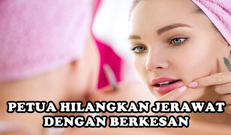 10 PETUA HILANGKAN JERAWAT DENGAN BERKESAN - BLOG MUMMY IDA