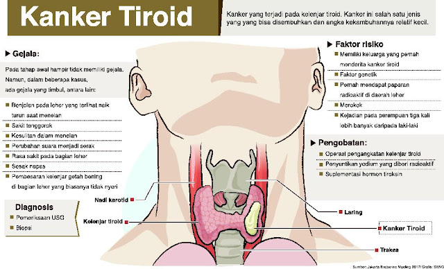 Penyakit Tiroid disertai Penyebaran Cancer dibeberapa tempat