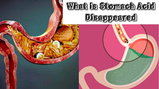 What happen when stomach acid disappeared