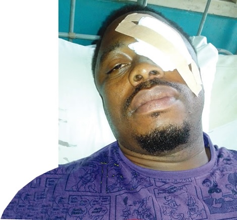 Controversy as Passenger's Eye is Damaged by Policemen Accused of Reckless Driving (Photo)