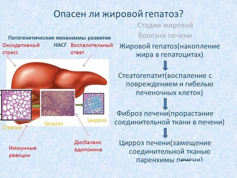 Печень 1 стадия