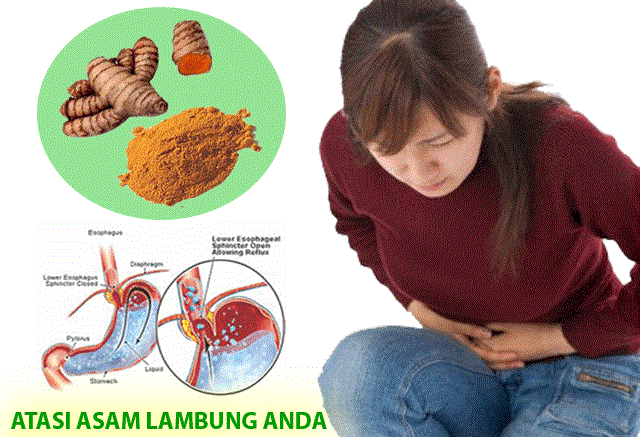 http://sakacamprung.blogspot.com/2016/05/cara-mengobati-asam-lambung.html