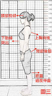 駝背治療, 駝背矯正,脊椎側彎 瑜珈