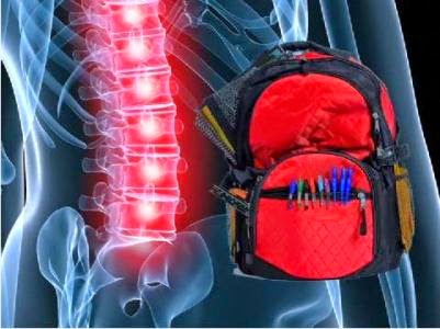 ATENÇÃO: Uso de mochilas e bolsas escolares muito pesadas podem causar problemas de coluna