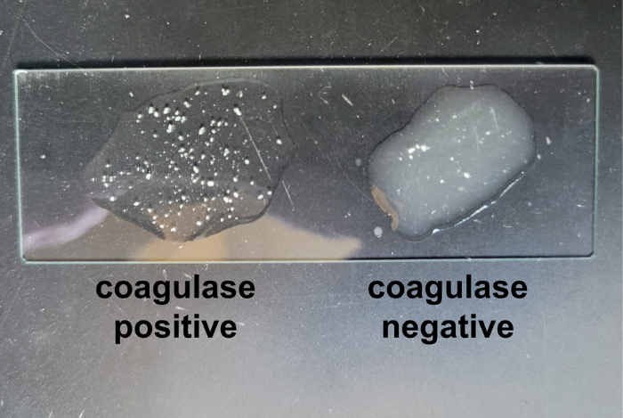 Uji Koagulase Streptococcus