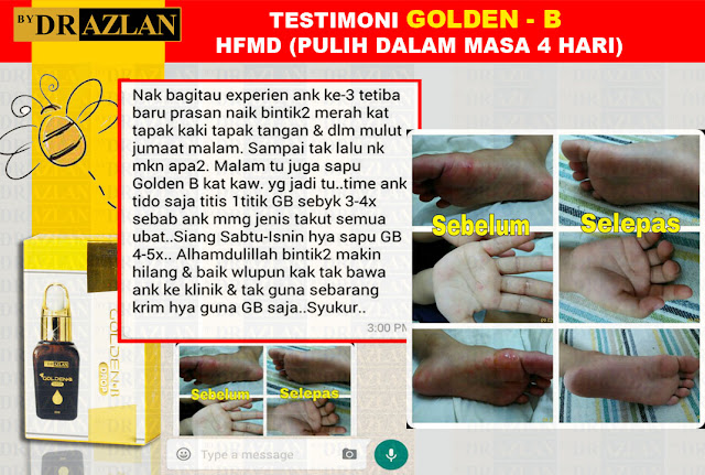 testimoni Golden-B bydrazlan