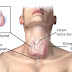 What is Thyroid?Structure,Limitation,Improvement,Thyroid hormones system,Guideline,Side effect,Cancer, Examination,Diagnosis Test etc...