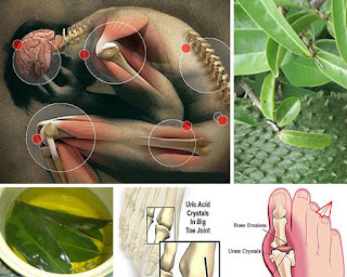 Pengobatan Asam Urat Alami Dengan Daun Sirsak