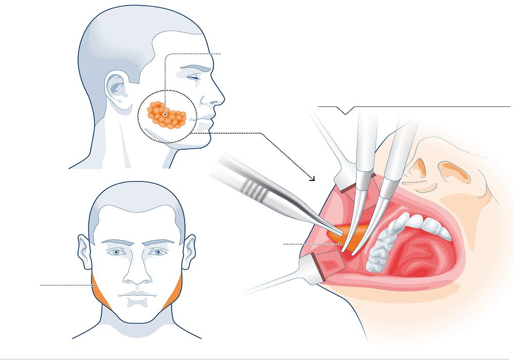 Cirurgia Oral