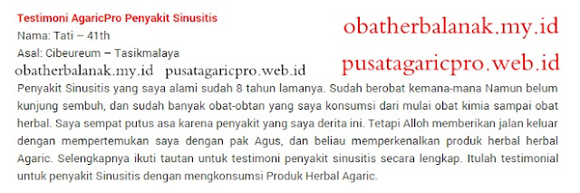 Obat Sinusitis Yang Sudah Terbukti Ampuh