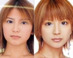 Morning Musume plastic surgery