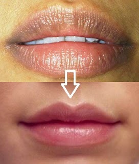 cara mengatasi bibir keriput secara alami 8 Cara Mengatasi Bibir yang Keriput Secara Alami. Anak Muda Wajib Baca Nih!