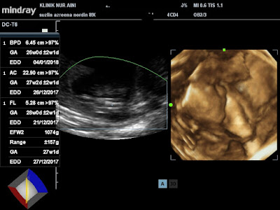 4d scan 26 weeks