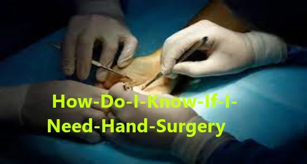Hand Surgery-How Do I Know If I Need Hand Surgery