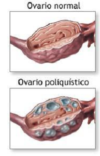 como puedo quedar embarazada con la inyeccion