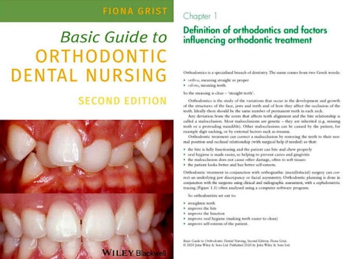 DENTAL BOOKS: Basic Guide to Orthodontic Dental Nursing - Fiona Grist