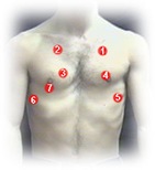 areas of auscultation in front