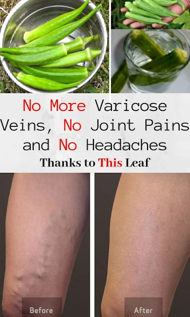 No More Varicose Veins, No Joint Pains and No Headaches Thanks to This Leaf
