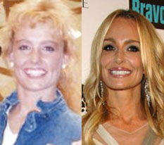 Taylor Armstrong Hair