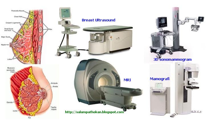 Deteksi Dini Kanker Payudara Menggunakan Alat Tehnologi 