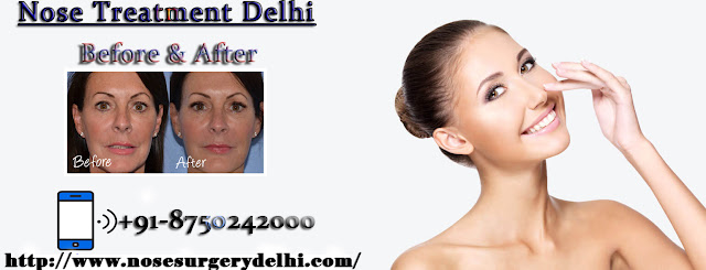 Nose Surgery Delhi