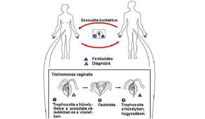 Gejala Klinis