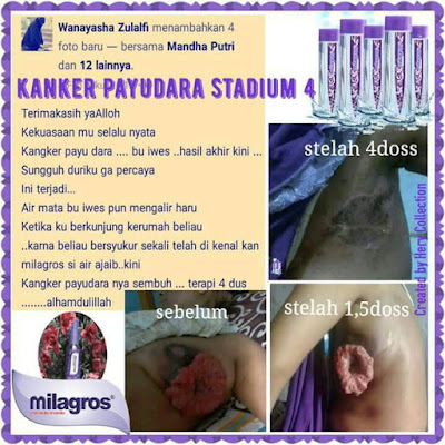 √ Tujuh Rahasia Tentang Kanker Payudara ⭐ Air Milagros