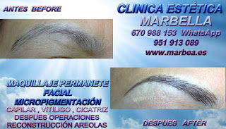 microblading cejas en Huelva Clínica Estética Maquillaje Permanente Facial,  Micropigmentación Capilar y microblading cejas Huelva y Marbella: Te ofrecemos la alta calidad de nuestroservicio con los mejores especialistas en micropigmentación capilar y microblading cejas