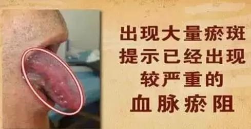 clip_image003