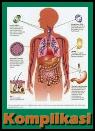 http://caramenyembuhkanpenyakitgondok.blogspot.com/2015/02/cara-ampuh-menyembuhkan-penyakit.html