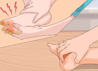 15 Best #Home #Remedies for #Sweaty 3Feet and #Hands (#Symptoms, #Causes, and #Prevention) 