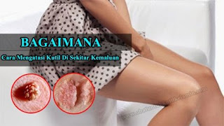 Obat alami untuk kutil kelamin, kapur sirih untuk obat kutil kelamin atau kutil di kemaluan, obat kutil kelamin alami bagus, penyebab kutil di kemaluan, penyebab kutil kelamin atau kutil di kemaluan pria, obat penyakit kutil pada kemaluan pria, biaya menghilangkan kutil kelamin atau kutil di kemaluan, obat kutil kelamin atau kutil di kemaluan tanpa efek samping, obat kutil kelamin luar tradisional, obat kutil kelamin atau kutil di kemaluan luar, kutil kelamin atau kutil di kemaluan lelaki