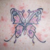 Tattoo Reactions / red tattoo ink allergy - pictures, photos - This is medically known as anaphylaxis.