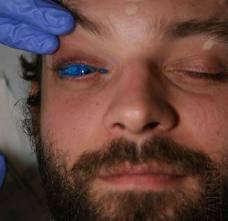 Men wth Extreme Eyes Tattoo with Blue Color