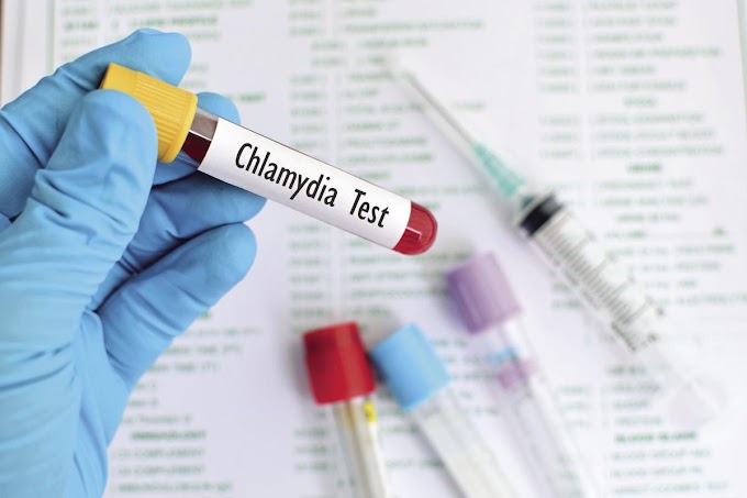 Xét nghiệm Chlamydia là gì? Xét nghiệm ở đâu tốt?