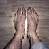 The ugliest feet